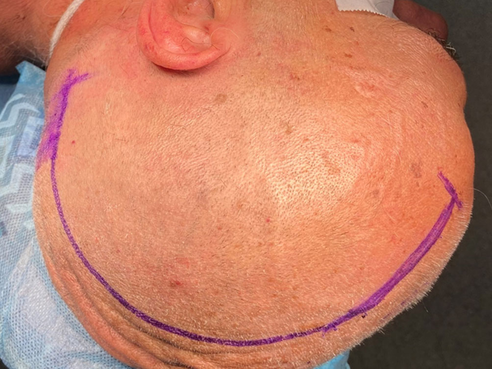 RIALTO clinical application image 01