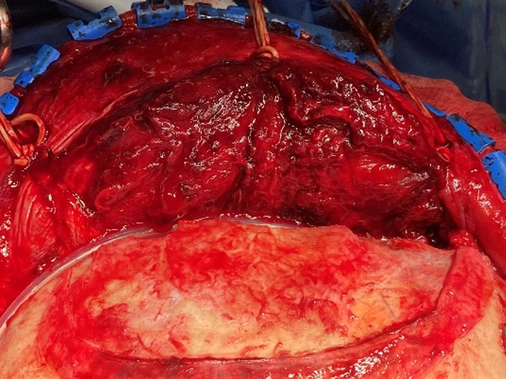 RIALTO clinical application image 02
