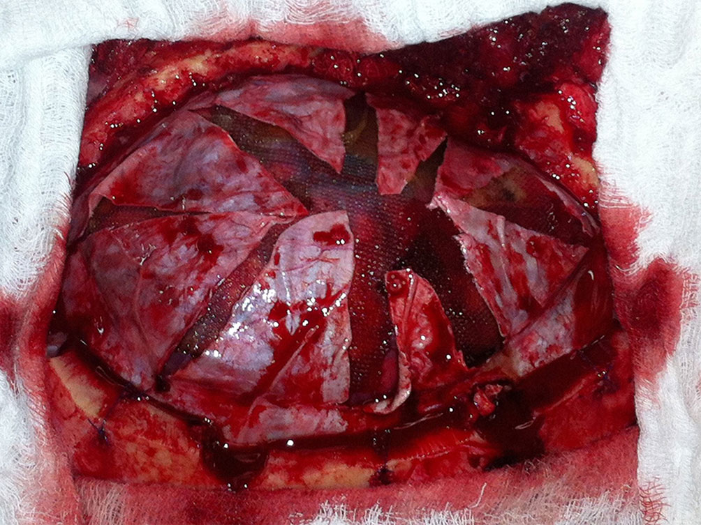 RIALTO clinical application image 03