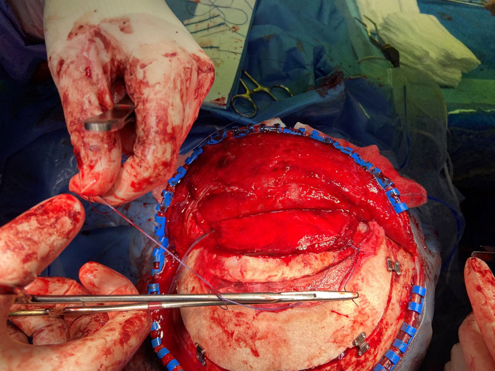 RIALTO clinical application image 04