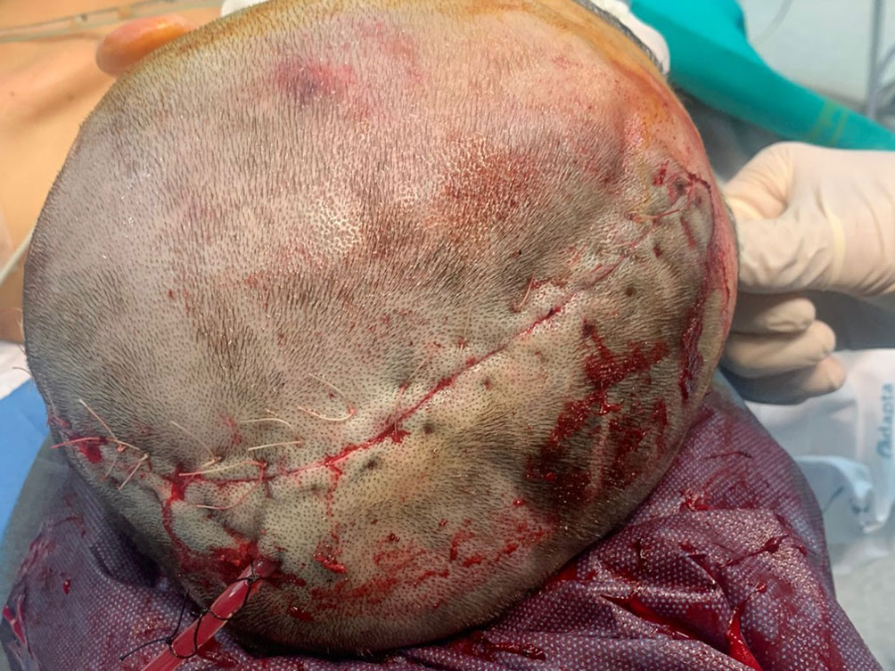 RIALTO clinical application image 05