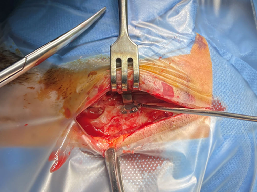 RIALTO clinical application image 06