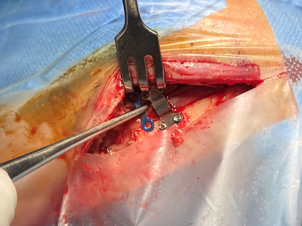 RIALTO clinical application image 07