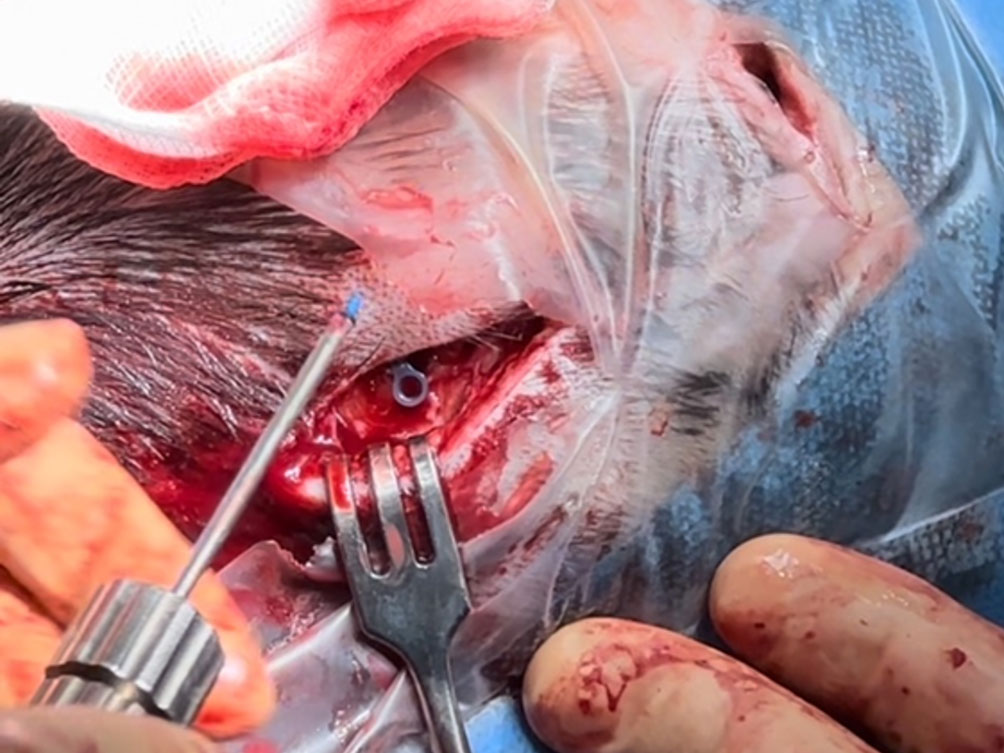 RIALTO clinical application image 08